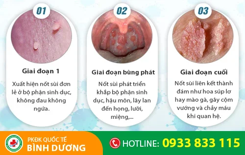 giai doan phat trien benh sui mao ga