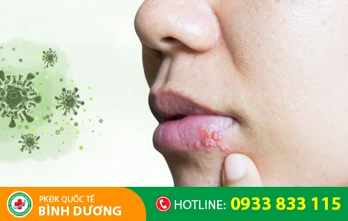 sui mao ga o mieng