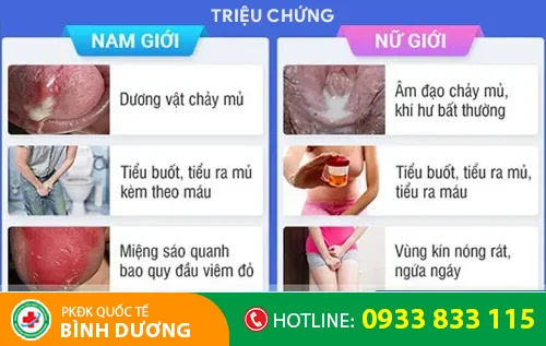 trieu chung benh lau